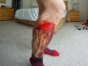Ouch!